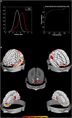 Structural Features Related to Affective Instability Correctly Classify Patients With Borderline Personality Disorder. A Supervised Machine Learning Approach